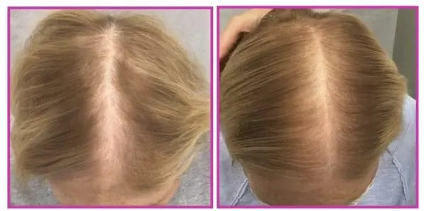 Spray Organic Cu Biotină Pentru Creşterea Părului