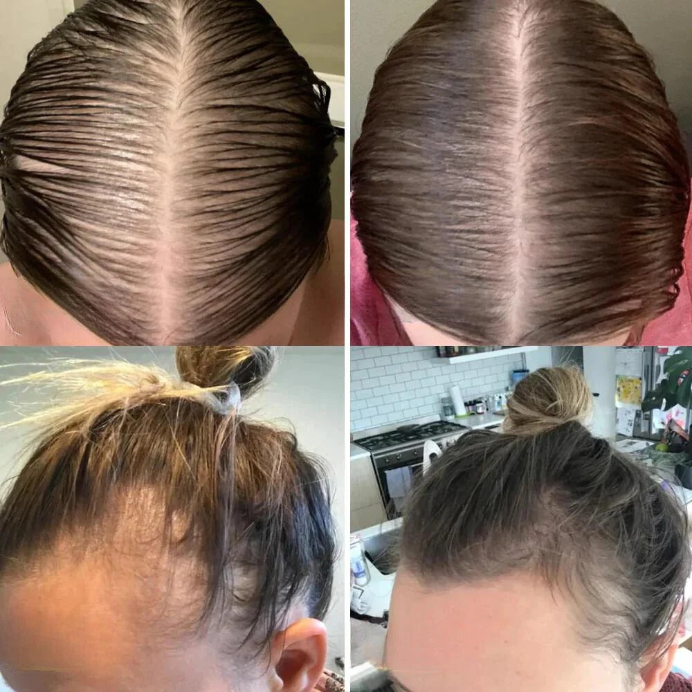 Spray Organic Cu Biotină Pentru Creşterea Părului