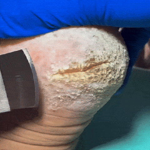 Crema ultra hidratanta pentru piele crapata si uscata