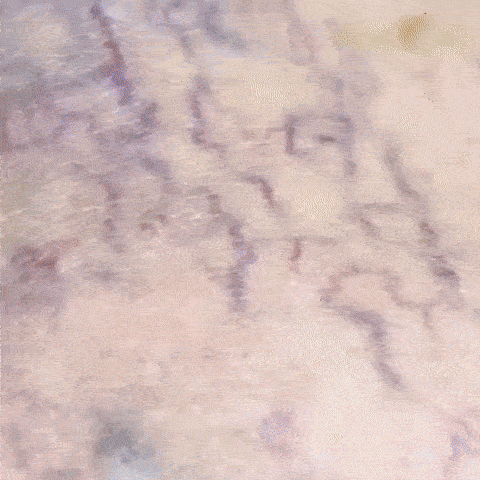 Spray natural pentru varice